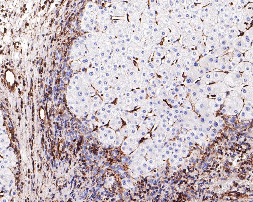 Vimentin Antibody (PDH0-01)