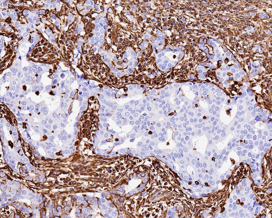 Vimentin Antibody (SC60-05)