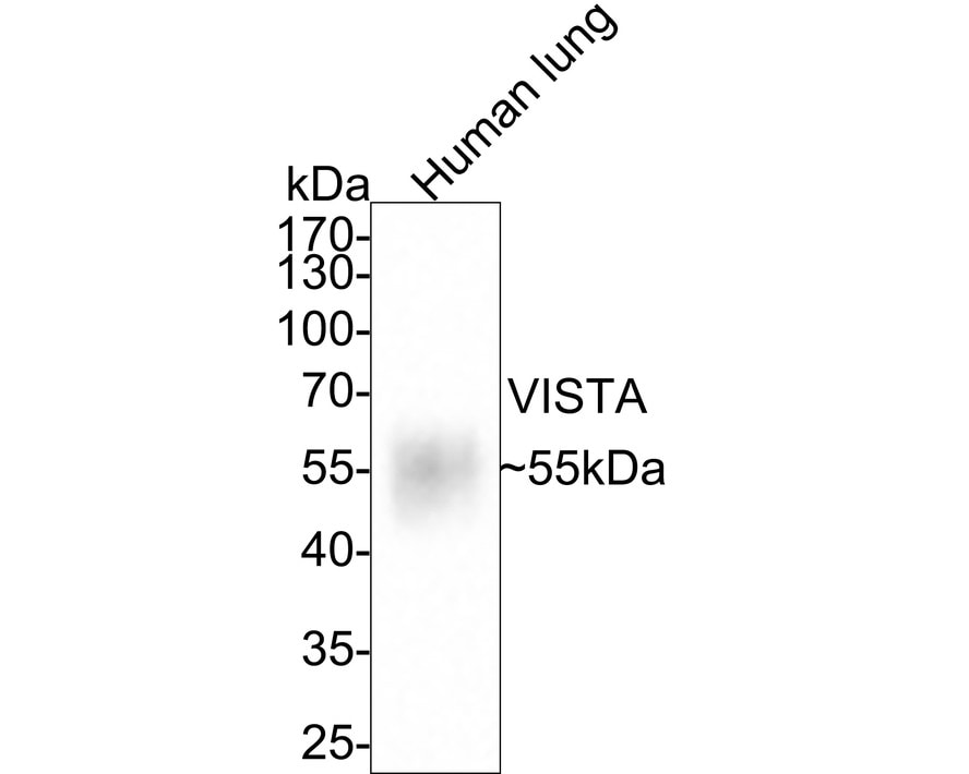 VISTA/B7-H5/PD-1H Antibody (PSH0-65)