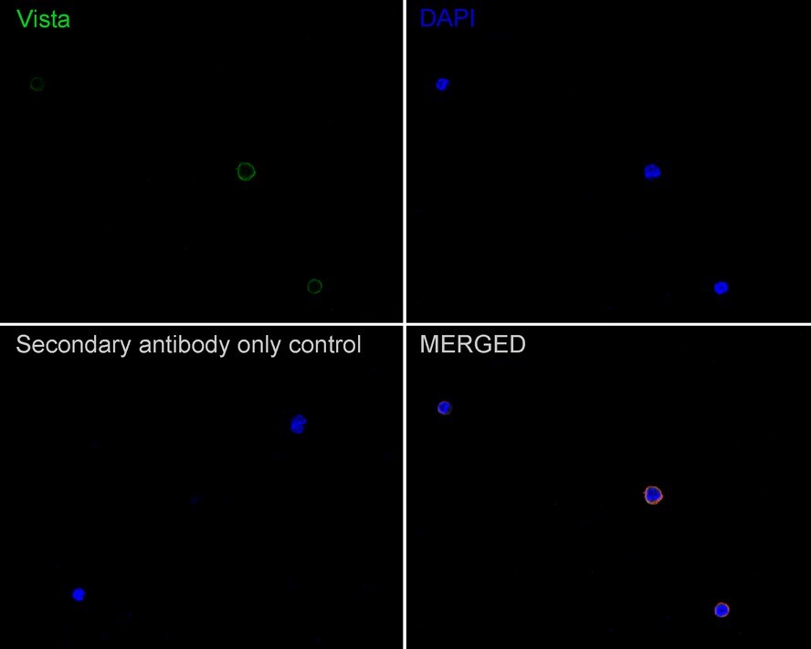 VISTA/B7-H5/PD-1H Antibody (PSH0-65)