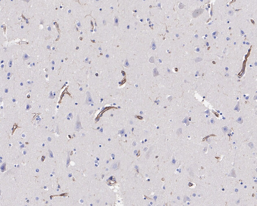 VISTA/B7-H5/PD-1H Antibody (PSH0-65)
