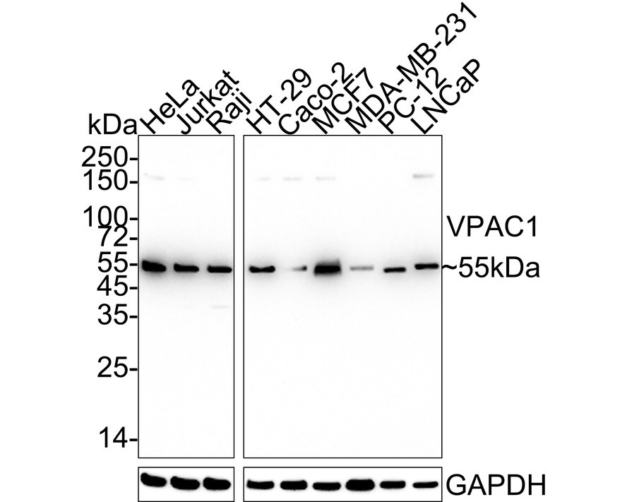 VIPR1/VPAC1 Antibody (PD00-96) Western Blot: VIPR1/VPAC1 Antibody (PD00-96) [NBP3-33097]