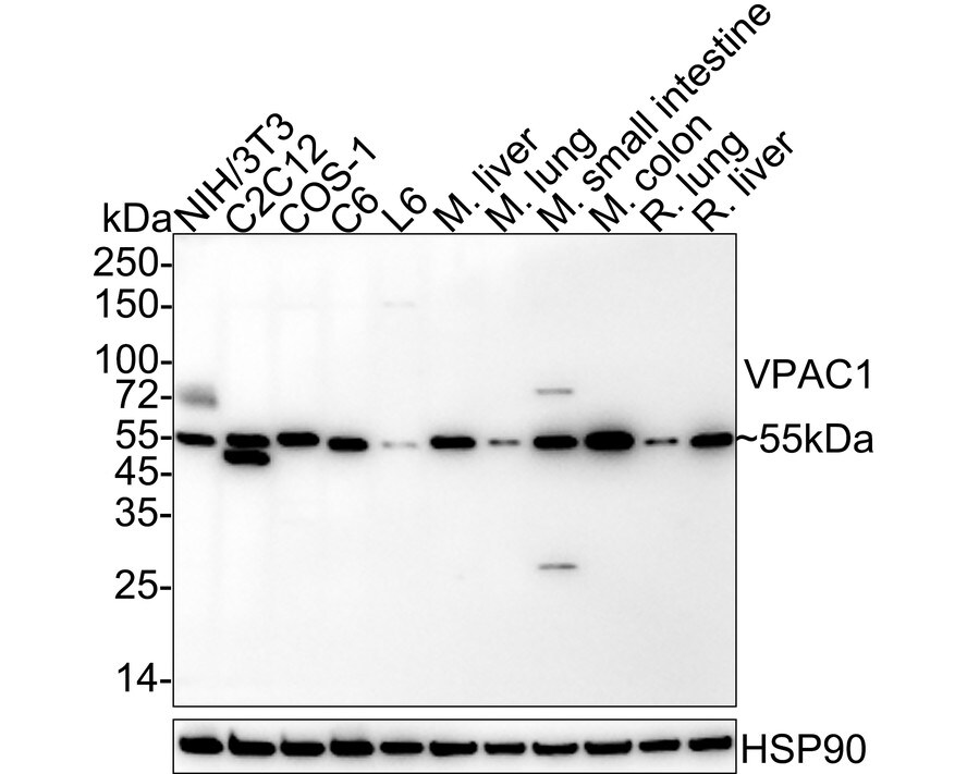 VIPR1/VPAC1 Antibody (PD00-96) Western Blot: VIPR1/VPAC1 Antibody (PD00-96) [NBP3-33097]