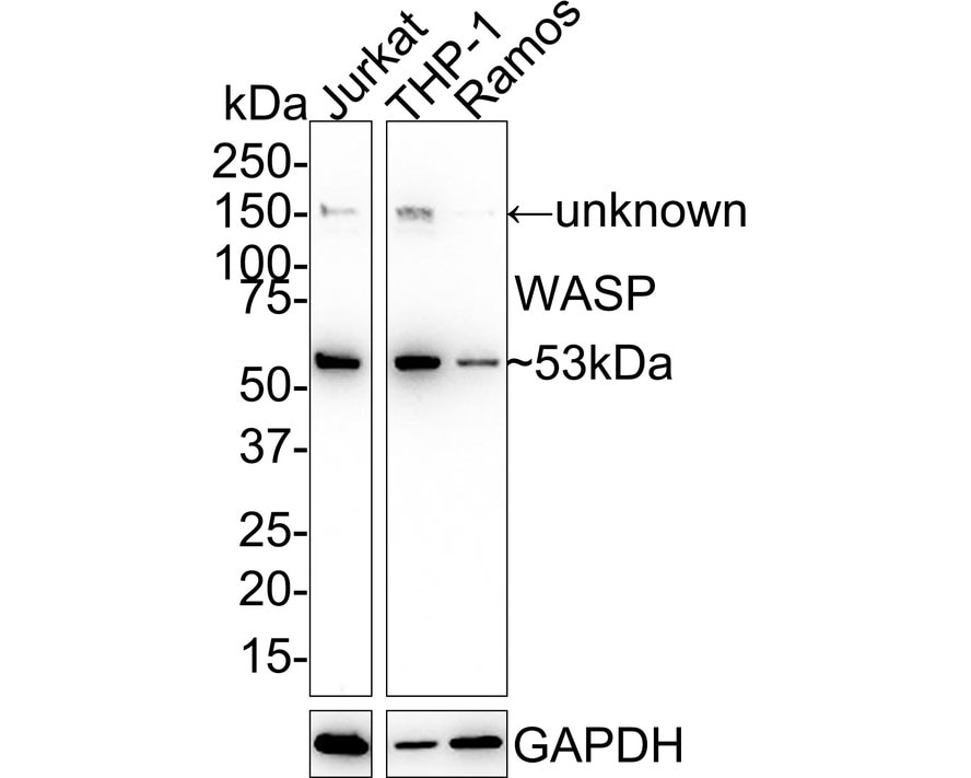 WASP Antibody (JE36-82) Western Blot: WASP Antibody (JE36-82) [NBP3-33098]