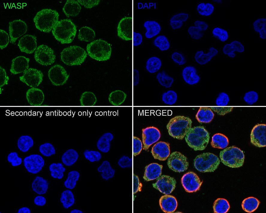 WASP Antibody (JE36-82)