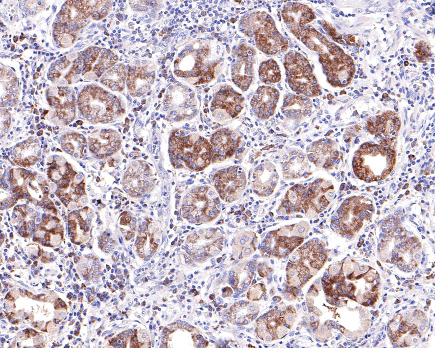 WDR1 Antibody (JE64-32)