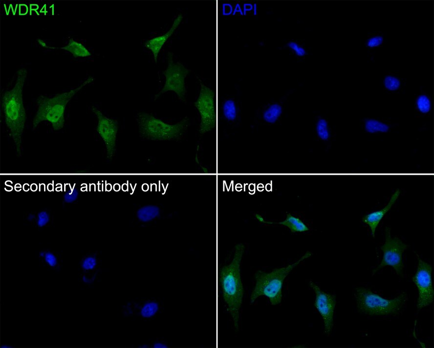 WDR41 Antibody (A9C10)
