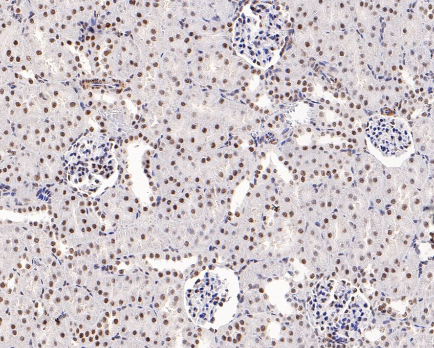 WDR41 Antibody (A9C10)