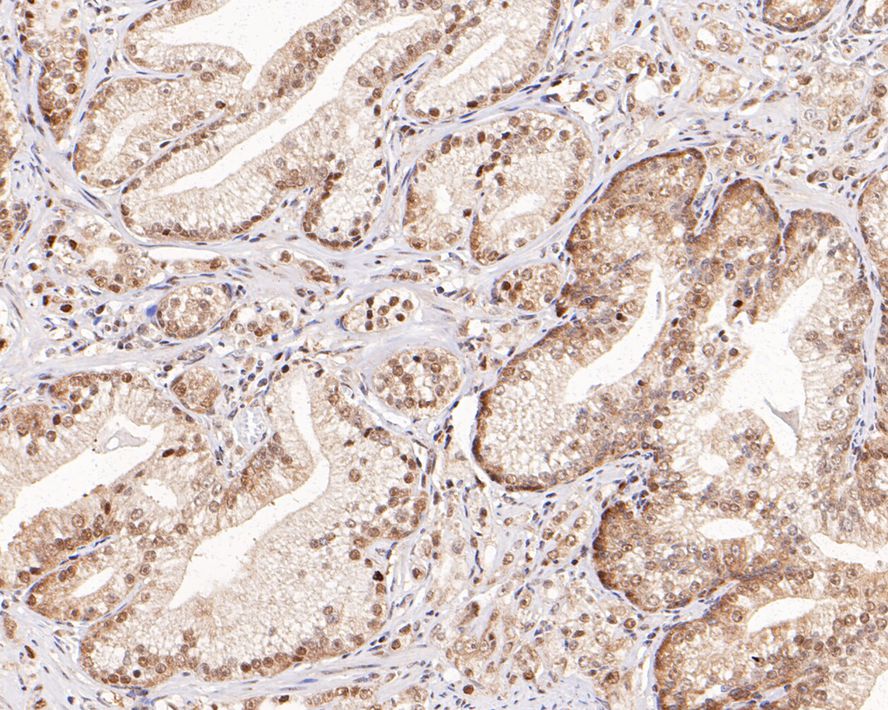 WDR77 Antibody (PSH0-07)
