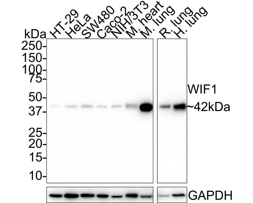 WIF-1 Antibody (JE41-39) Western Blot: WIF-1 Antibody (JE41-39) [NBP3-33102]