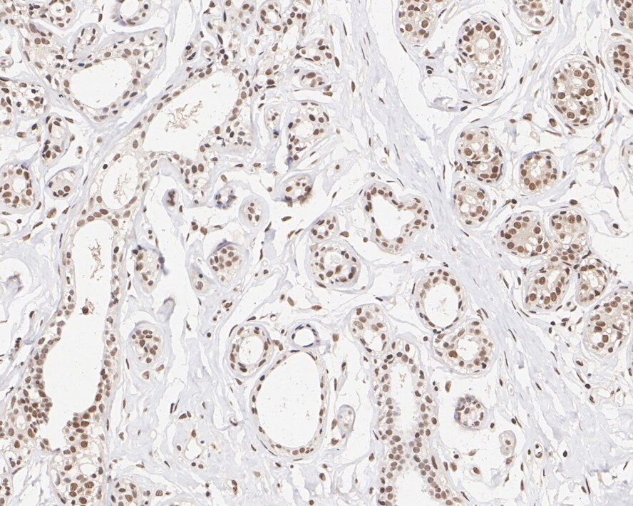 XLF Antibody (PSH01-07)