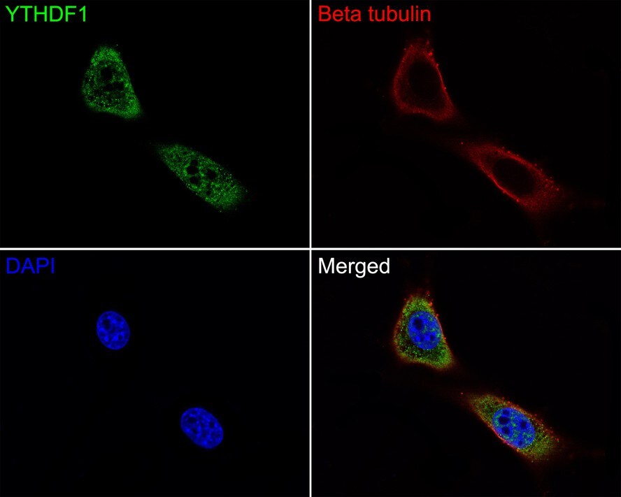 YTHD1 Antibody