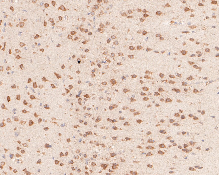 YTHD1 Antibody