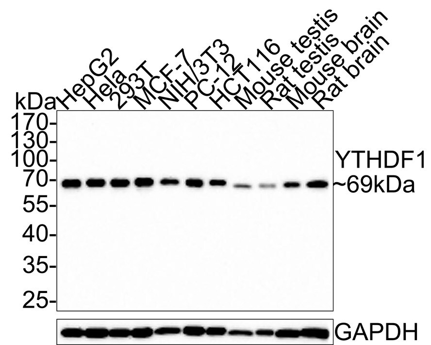 YTHD1 Antibody (PSH0-23) Western Blot: YTHD1 Antibody (PSH0-23) [NBP3-33109]