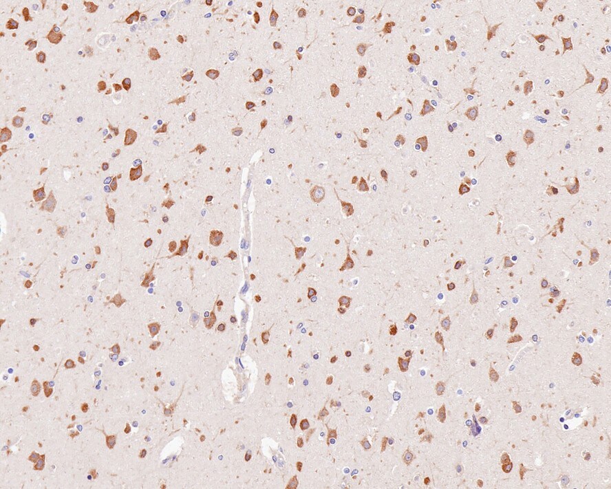 YTHD1 Antibody (PSH0-23)