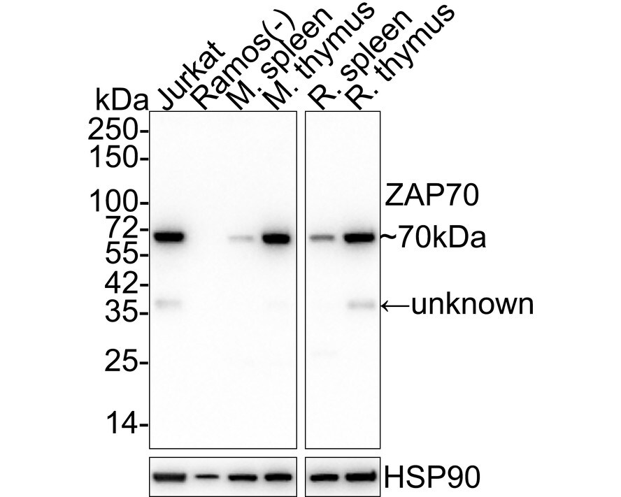 ZAP70 Antibody (A1B5-R) Western Blot: ZAP70 Antibody (A1B5-R) [NBP3-33110]