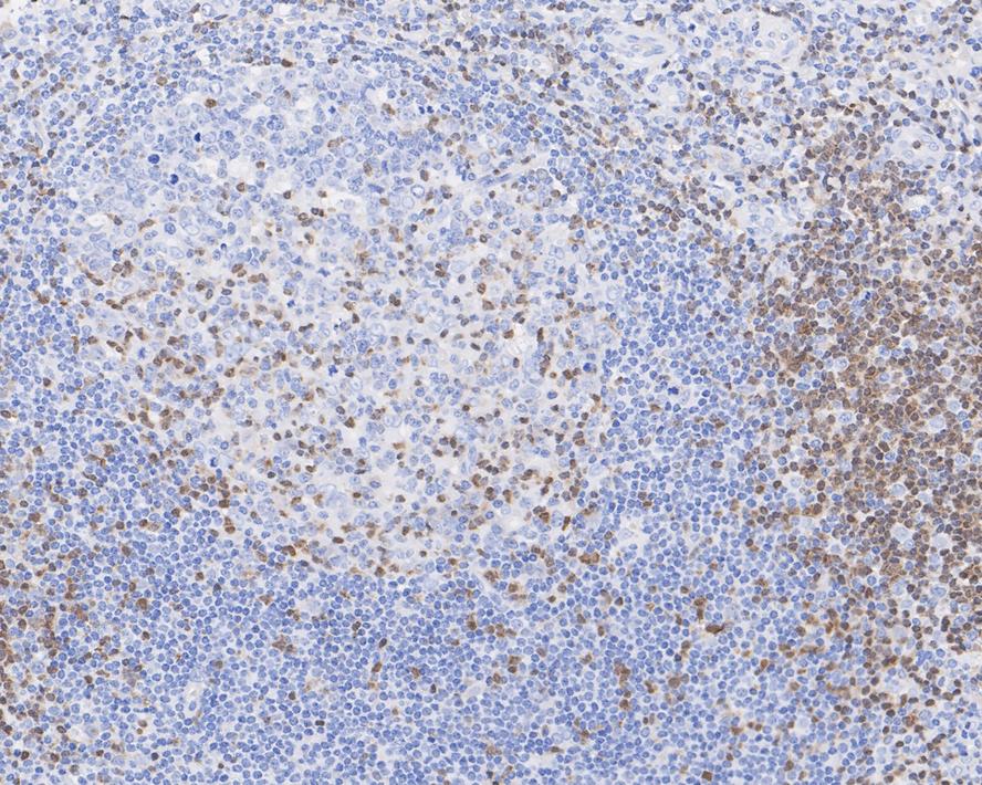 ZAP70 Antibody (A1B5-R)