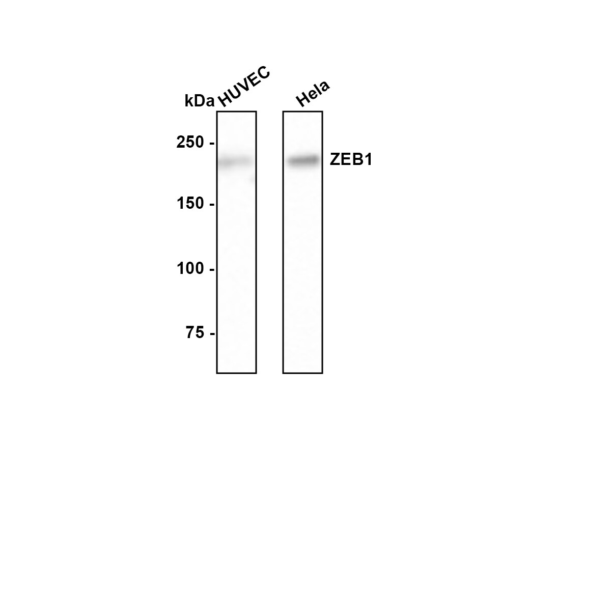 ZEB1 Antibody (JE57-64) Western Blot: ZEB1 Antibody (JE57-64) [NBP3-33111]
