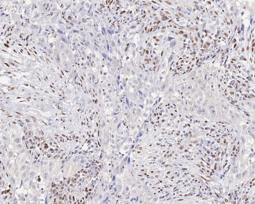 ZEB1 Antibody (JE57-64)