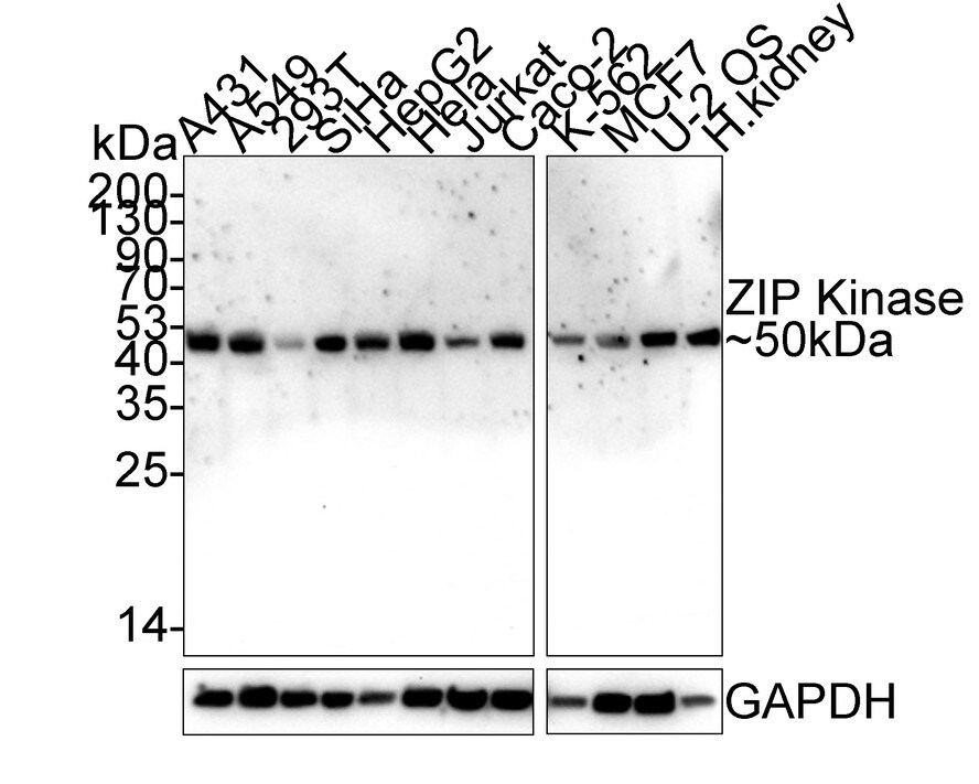 DAPK3/ZIPK Antibody (PSH02-18) Western Blot: DAPK3/ZIPK Antibody (PSH02-18) [NBP3-33113]