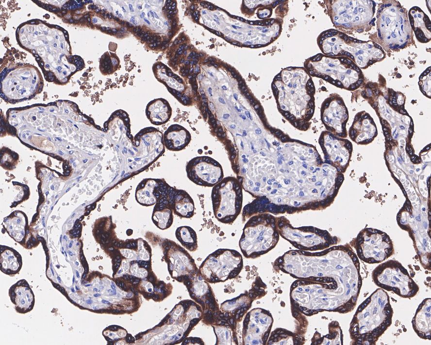 Chorionic Gonadotropin beta Chain (hCG beta) Antibody (JE45-04)