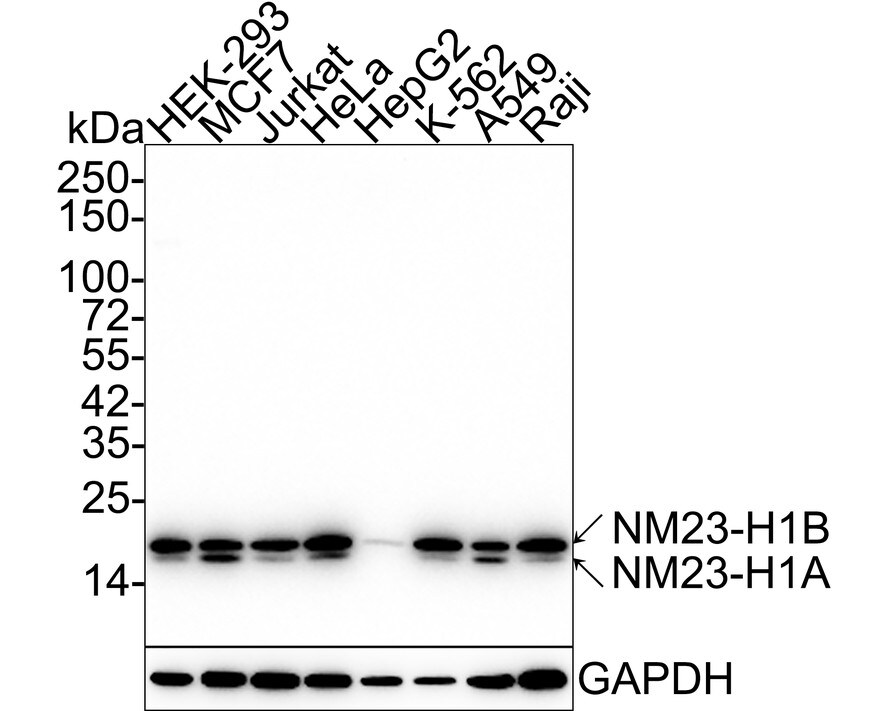 NM23-H1 Antibody (13C1-R) Western Blot: NM23-H1 Antibody (13C1-R) [NBP3-33131]