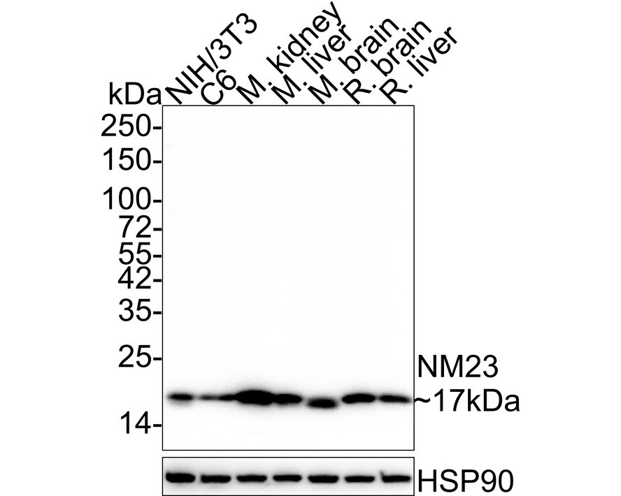 NM23-H1 Antibody (13C1-R) Western Blot: NM23-H1 Antibody (13C1-R) [NBP3-33131]