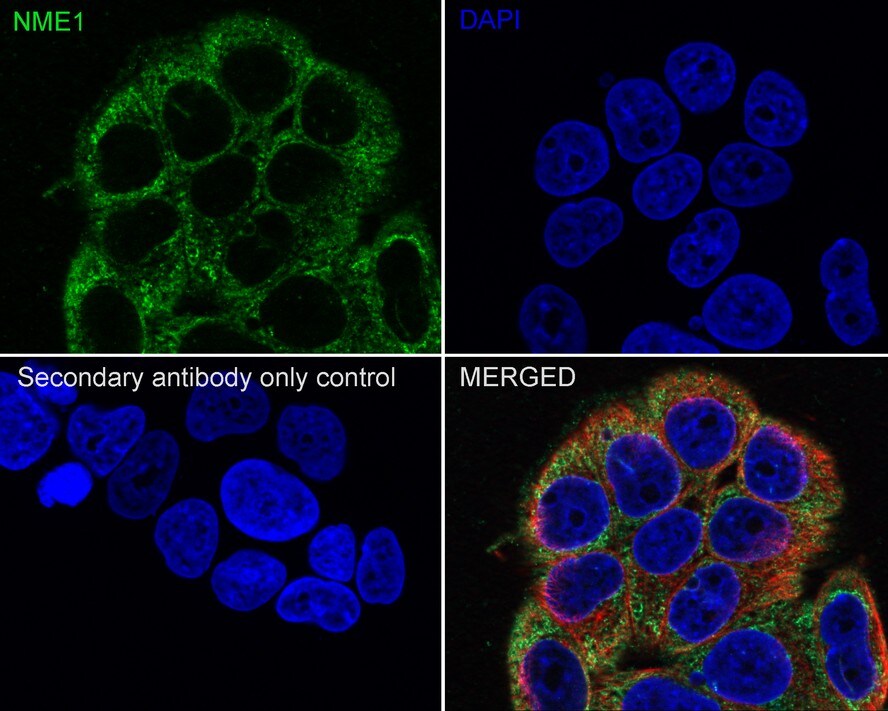NM23-H1 Antibody (13C1-R)