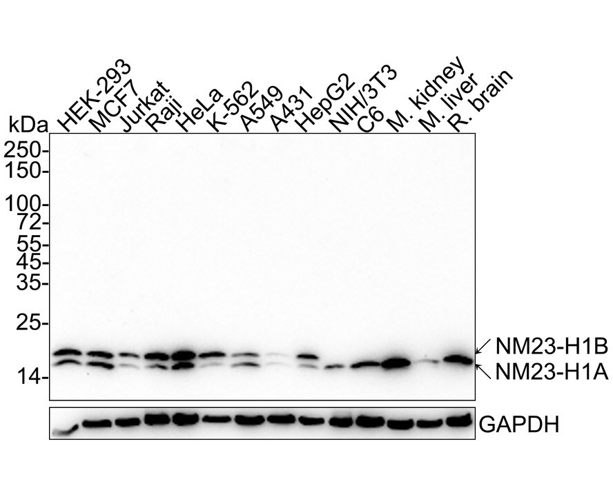 NM23-H1 Antibody (13C2-R) Western Blot: NM23-H1 Antibody (13C2-R) [NBP3-33132]