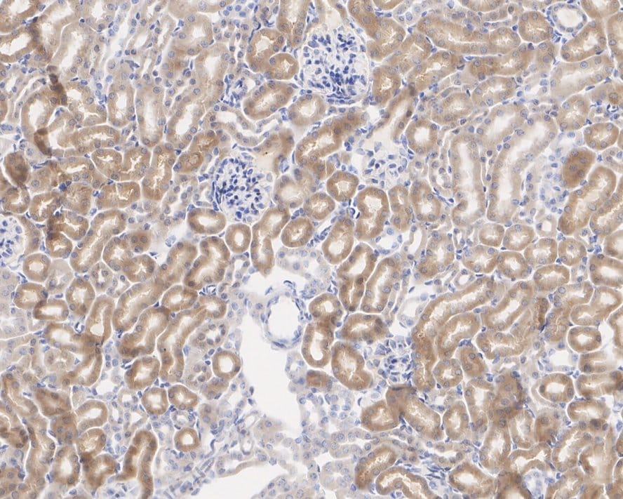 NM23-H1 Antibody (13C2-R)
