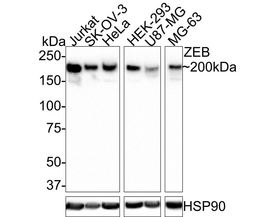 ZEB1 Antibody (PSH0-61)