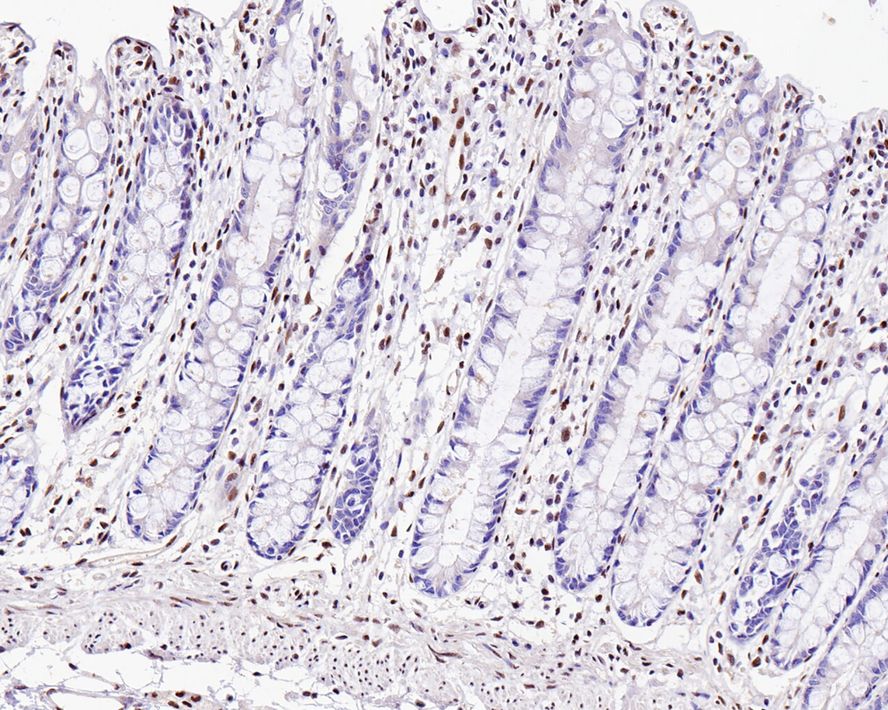ZEB1 Antibody (PSH0-61)