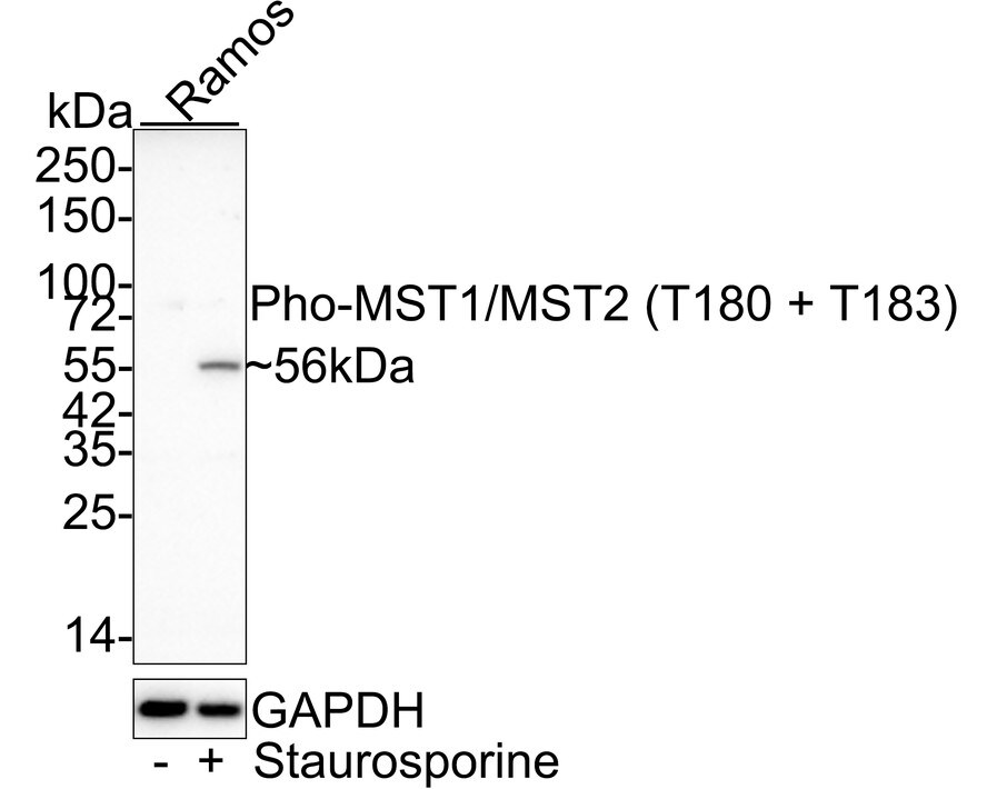 MST1/2 [p Thr180, p Thr183] Antibody (JE46-64)
