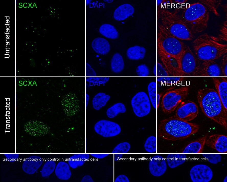 SCX Antibody (PSH02-25)