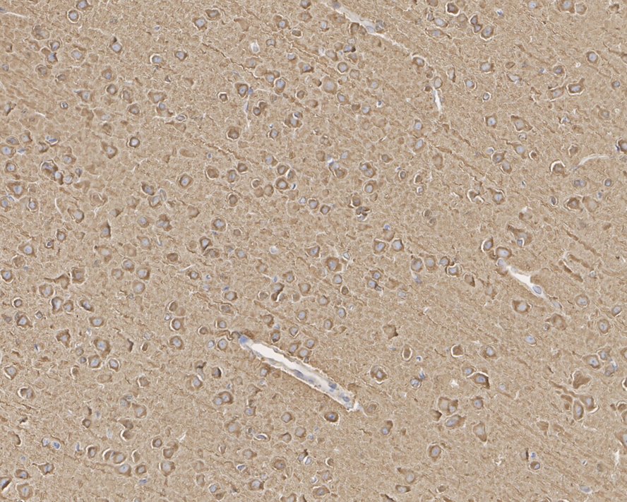 alpha Tubulin Antibody (PSH02-95)