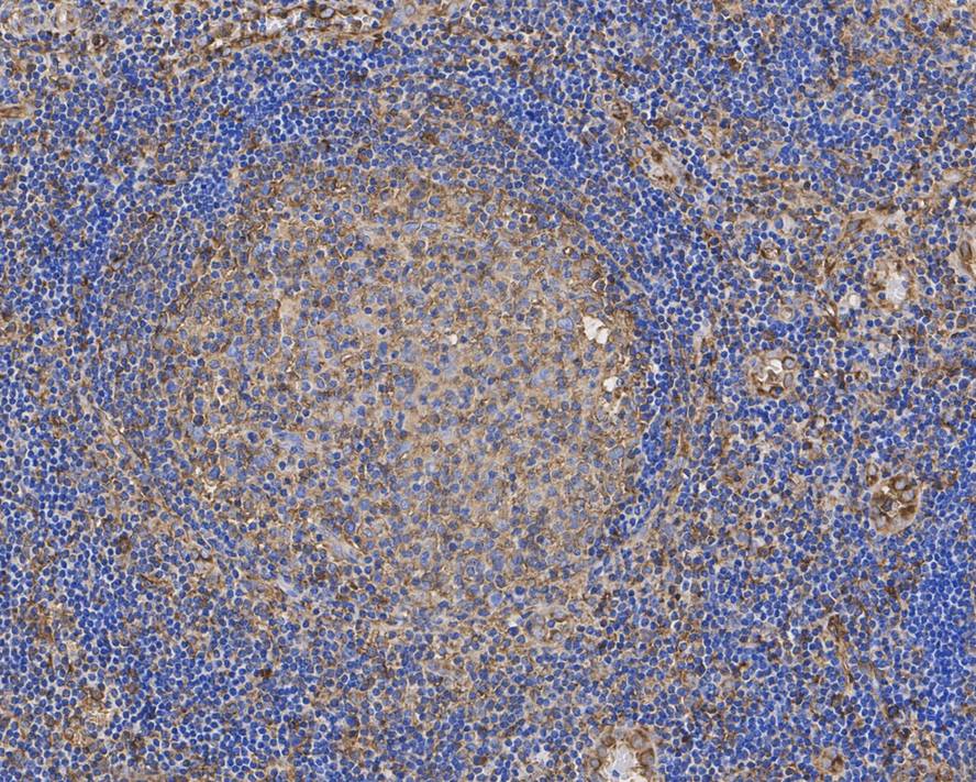 alpha Tubulin Antibody (PSH02-95)
