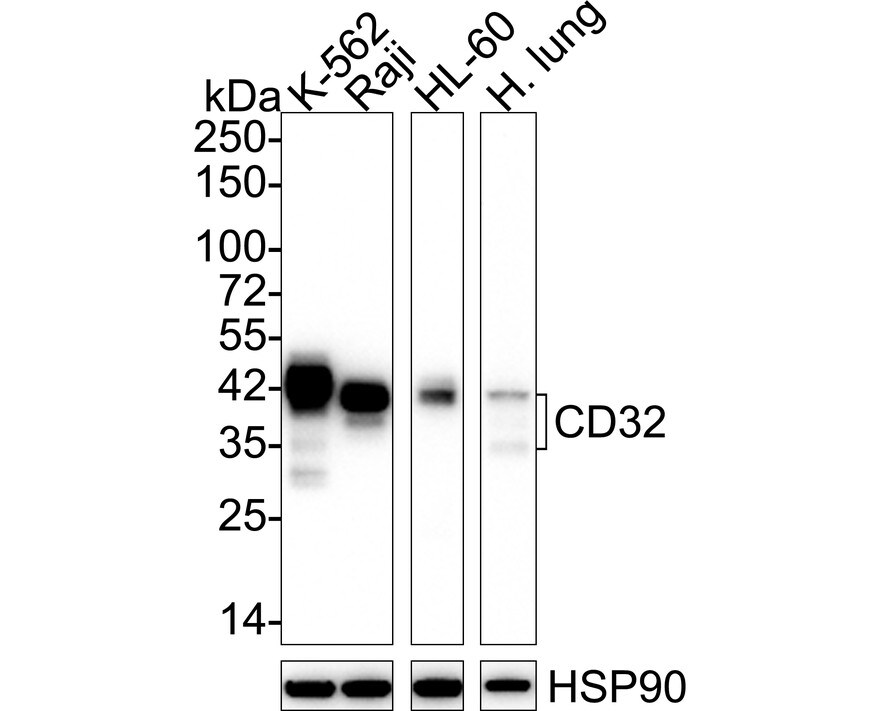 Fc gamma RIIA/CD32a Antibody (JE64-17) Western Blot: Fc gamma RIIA/CD32a Antibody (JE64-17) [NBP3-33141]