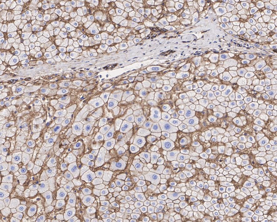 Sodium Potassium ATPase Alpha 1 Antibody (ST0533)