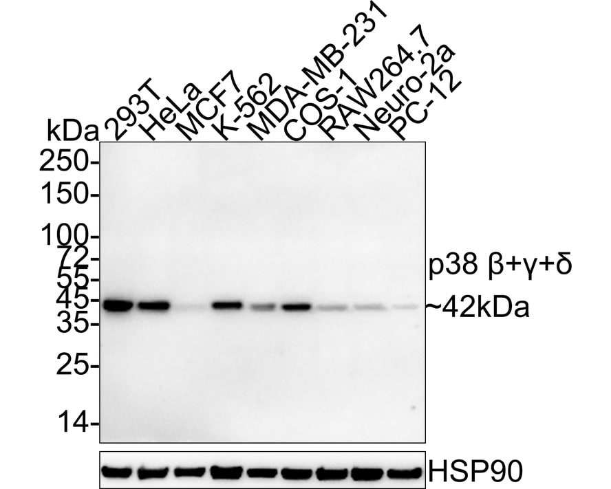 p38 beta/gamma/delta Antibody (PSH03-59) Western Blot: p38 beta/gamma/delta Antibody (PSH03-59) [NBP3-33145]