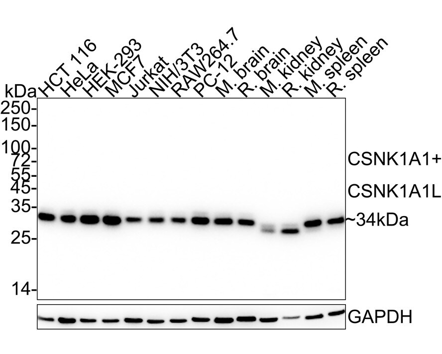 CSNK1A1/CSNK1A1L Antibody (PSH04-58) Western Blot: CSNK1A1/CSNK1A1L Antibody (PSH04-58) [NBP3-33146]