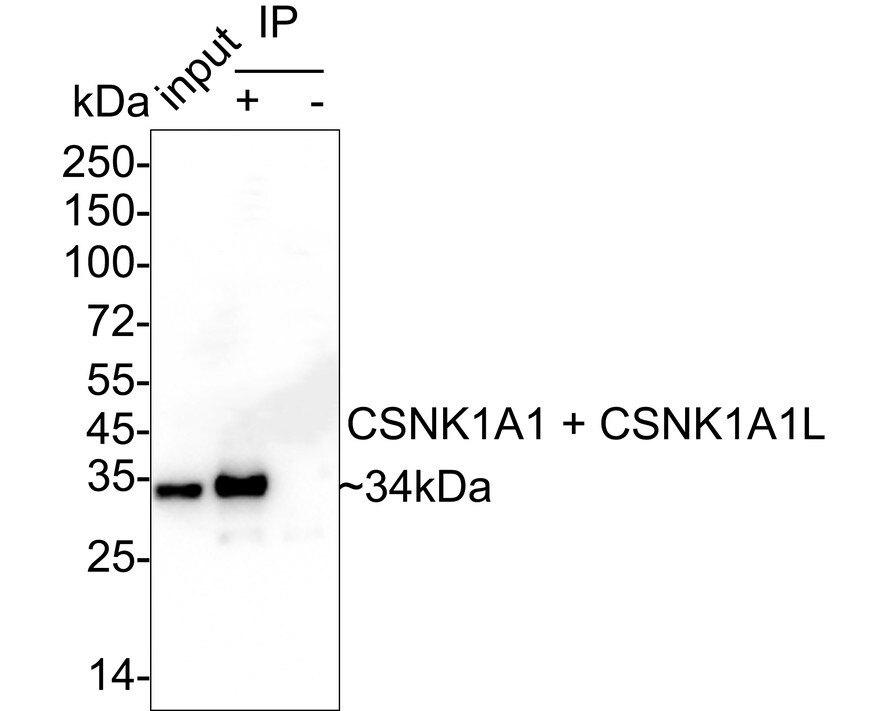 CSNK1A1/CSNK1A1L Antibody (PSH04-58)