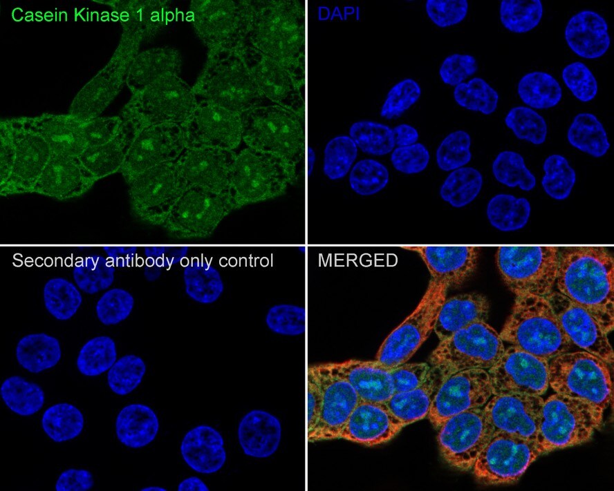 CSNK1A1/CSNK1A1L Antibody (PSH04-58)