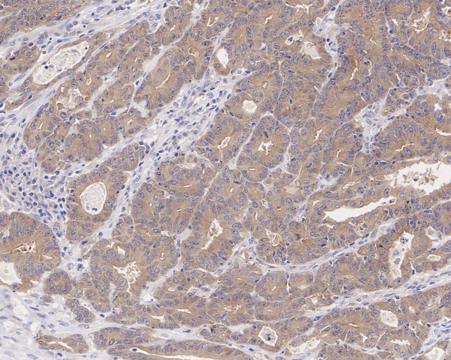 CSNK1A1/CSNK1A1L Antibody (PSH04-58)