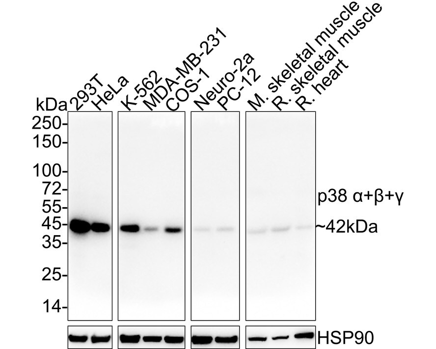 p38 alpha/beta/gamma Antibody (PSH03-60) Western Blot: p38 alpha/beta/gamma Antibody (PSH03-60) [NBP3-33147]
