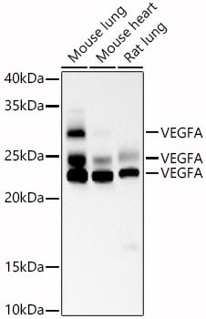 VEGF Antibody (9P0F4)