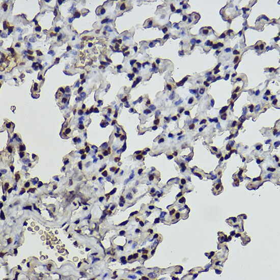 Histone H2B [Formyl Lys108] Antibody (2L4X5)