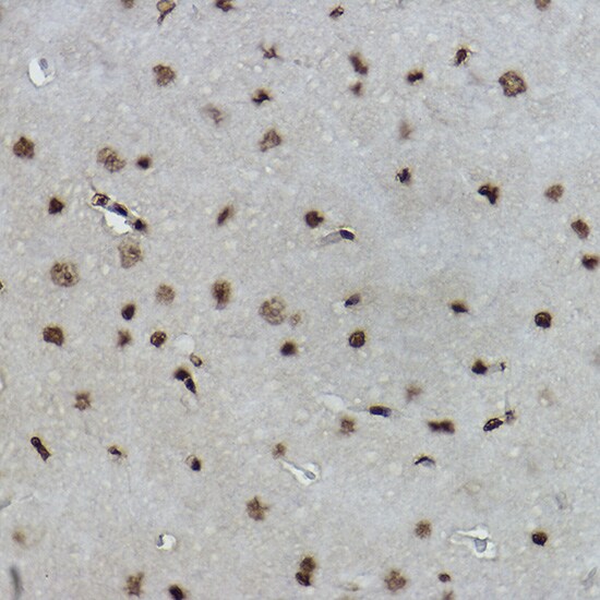 Histone H2B [Formyl Lys108] Antibody (2L4X5)