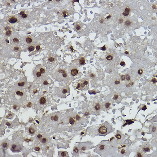 Histone H2B [Formyl Lys108] Antibody (2L4X5)