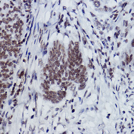 Histone H2B [Monomethyl Lys116] Antibody (3R10S2)