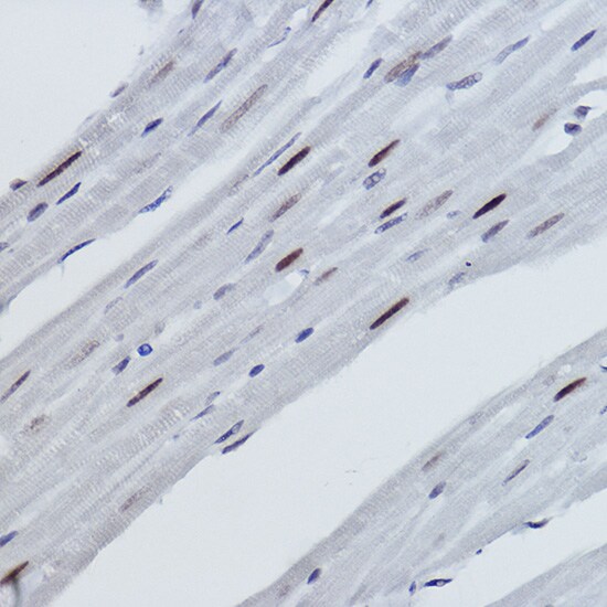 Histone H2B [Monomethyl Lys116] Antibody (3R10S2)